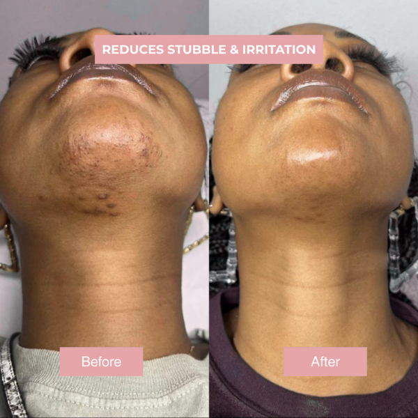 EPURA™- Cyperus Rotundus Skin Serum