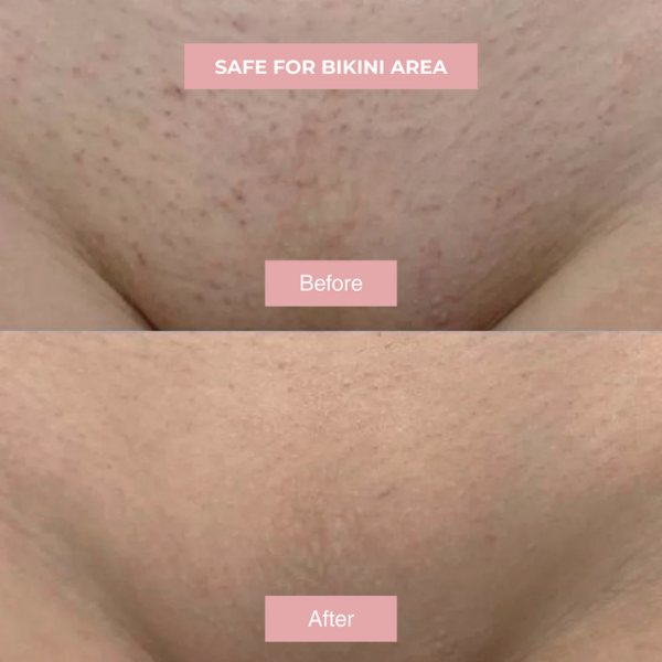 EPURA™- Cyperus Rotundus Skin Serum