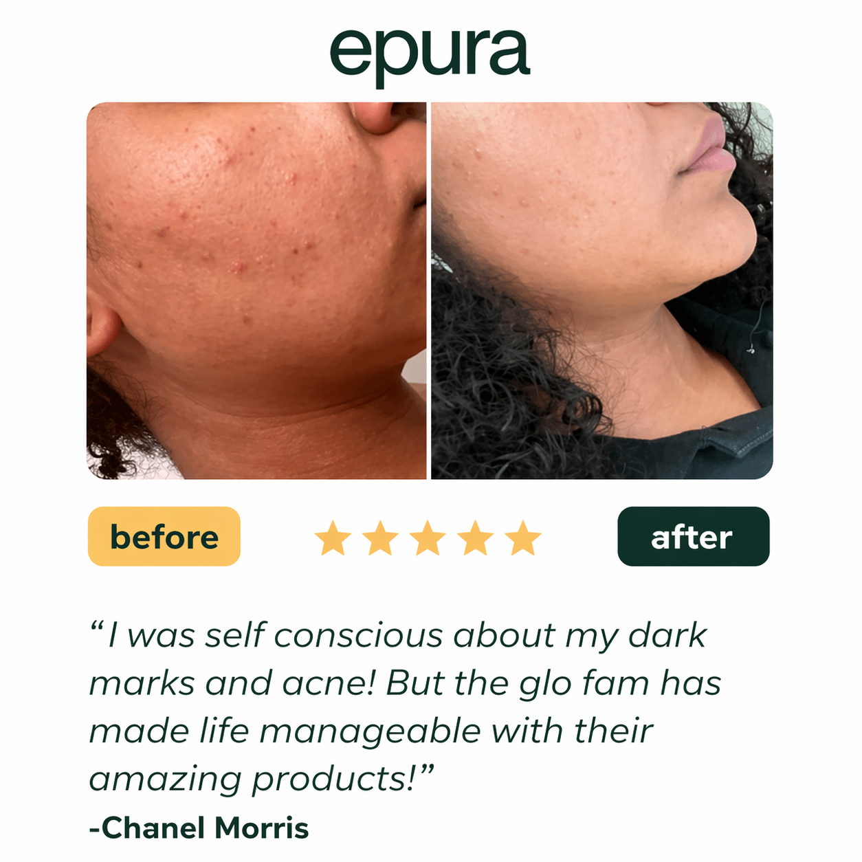 Epura™ lemon, turmeric & kojic acid brightening soap