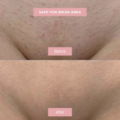 EPURA™- Cyperus Rotundus Skin Serum