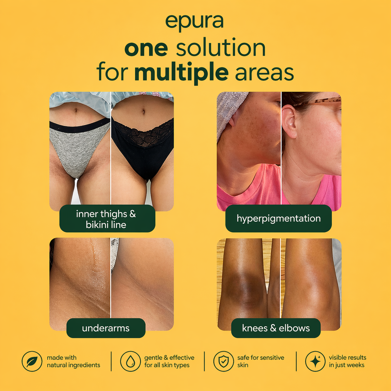 Epura™ lemon, turmeric & kojic acid brightening soap