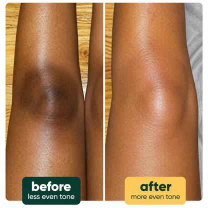 Epura™ lemon, turmeric & kojic acid brightening soap