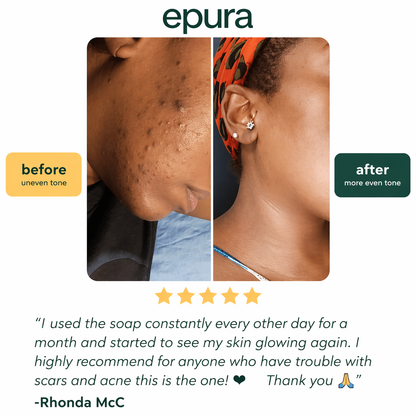 Epura™ lemon, turmeric & kojic acid brightening soap