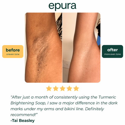 Epura™ lemon, turmeric & kojic acid brightening soap